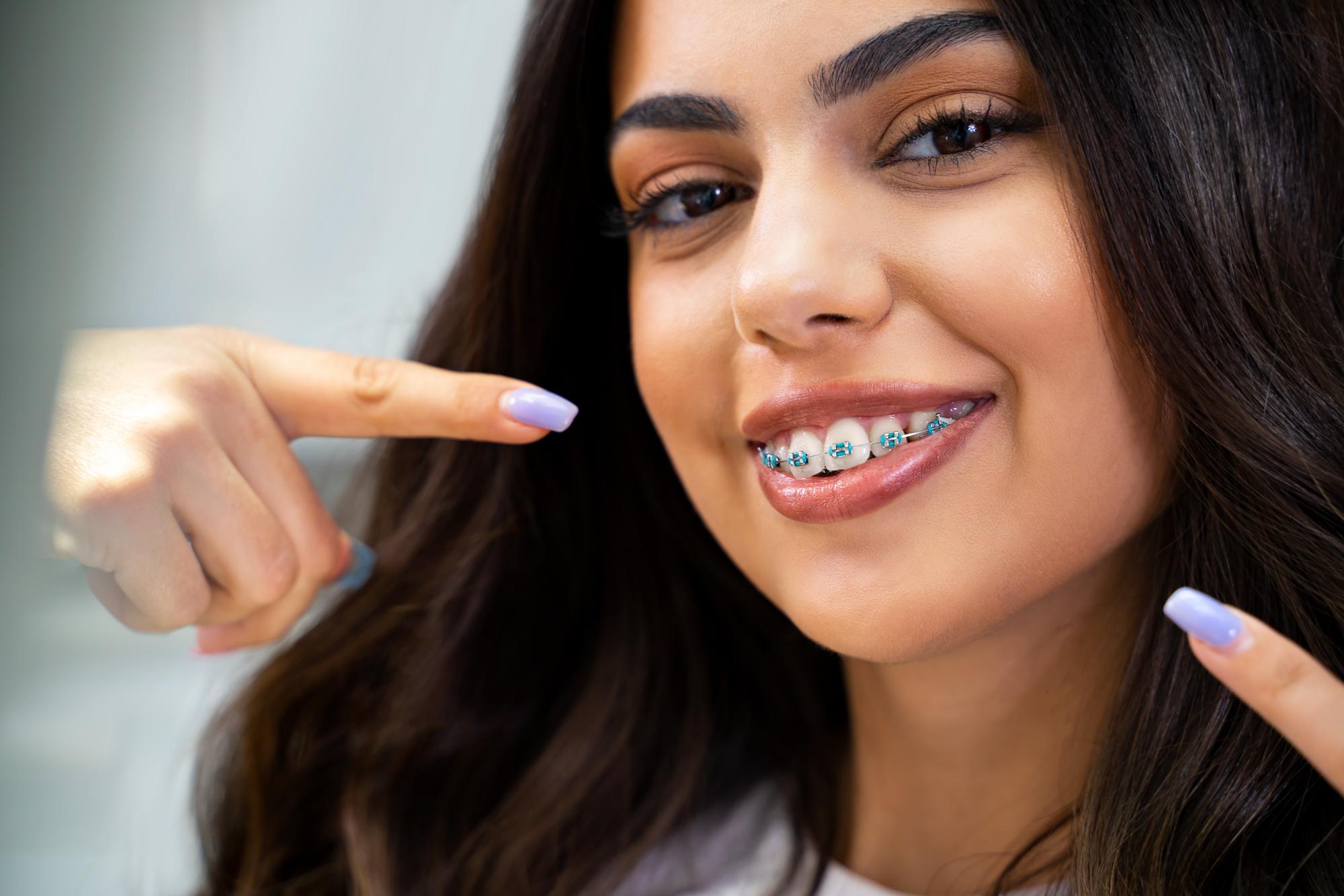 albany braces