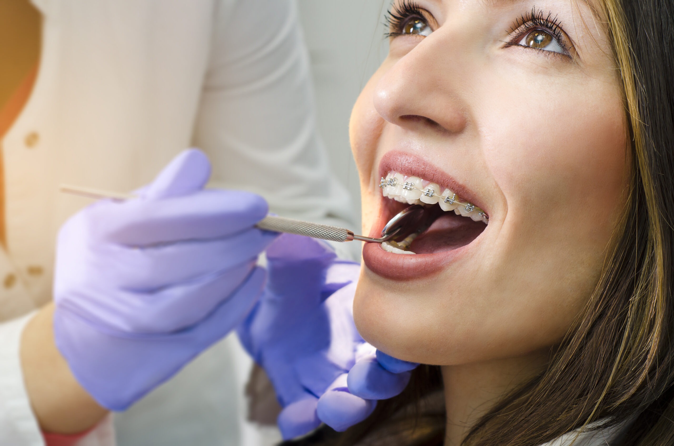 Braces vs. Invisalign: Different Paths to the Same Perfect Smile
